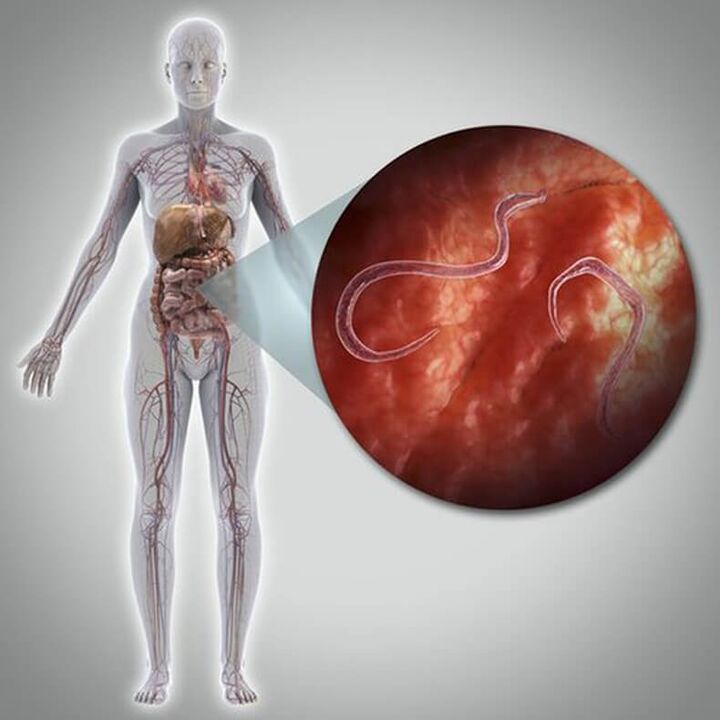 Parasiten im Körper einer Person